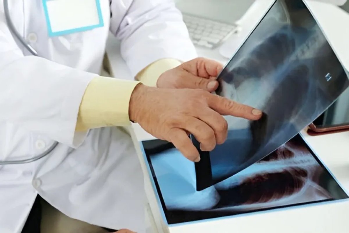 Neuqu&eacute;n: todos los establecimientos de salud realizan an&aacute;lisis de tuberculosis